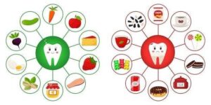 Read more about the article How Diet Affects Your Dental Health: Foods to Eat and Avoid